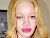 diandra-forrest-albino-black-beauty-model-image-pic