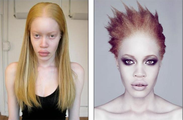 Albino Black People Model Diandra Forrest African American