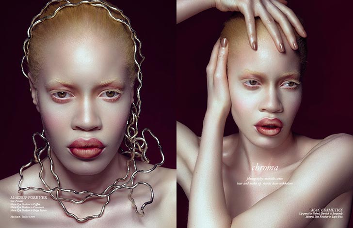 albino-black-fashion-model-beauty-diandra-forrest-schon-magazine-2014
