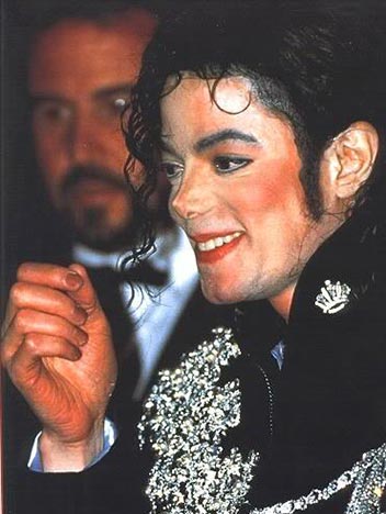 michael-jackson-vitiligo-skin-disease-condition-photo-picture-2