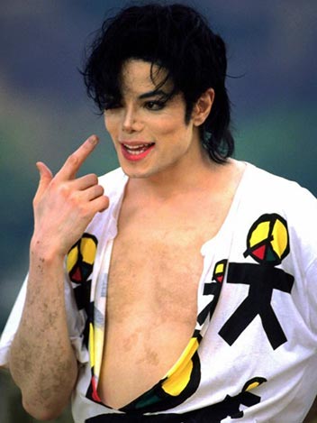 michael-jackson-vitiligo-skin-disease-condition-photo-picture